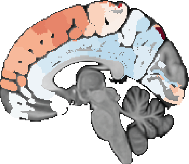 Parcellated GluCEST map of the human brain showing regional glutamate-weighted contrast